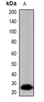 TPSD1 antibody