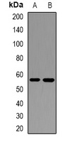 Anti-IL-17RB Antibody