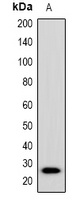 Anti-Placental Lactogen Antibody