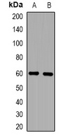 Anti-ZFP91 Antibody