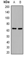 Anti-Complement C8 beta Antibody