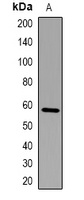 Anti-FBXO7 Antibody