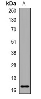 Anti-PLGRKT Antibody