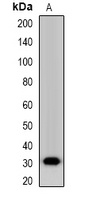 NANOS1 antibody