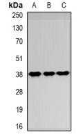 Anti-SPFH1 Antibody