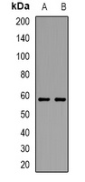 Anti-TRP2 Antibody
