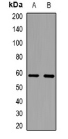 Anti-TRP2 Antibody