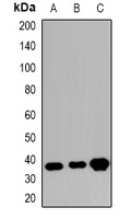 Anti-PMEPA1 Antibody