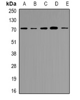 Anti-NRG1 Antibody