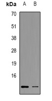 Anti-LC3B Antibody