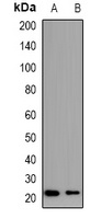Anti-BID (Phospho-S78) Antibody