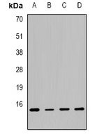 CGRP antibody