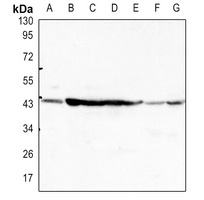 Anti-Beta-actin Antibody