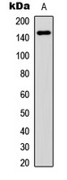 Anti-VEGFR1 Antibody