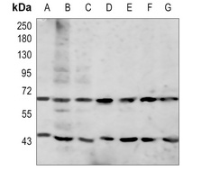 Anti-GAS6 Antibody