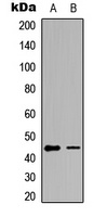 GATA1 (Phospho-S142) antibody