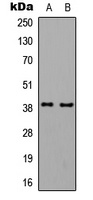Anti-GNAL Antibody