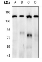Anti-GPR158 Antibody