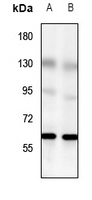 Anti-GPR56 Antibody