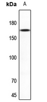 Anti-NMDAR2D Antibody