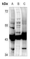 Anti-GSK3 beta (Phospho-S9) Antibody