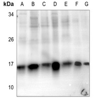 Anti-Histone H2B (Acetyl-K5) Antibody