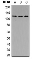 HDAC5 (Phospho-S259/220) antibody