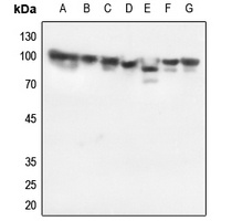Anti-HSP90 beta Antibody