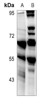 Anti-CD213a2 Antibody