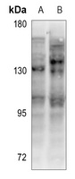 Anti-CD130 Antibody
