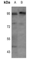 Anti-Insulin Receptor (Phospho-Y1355) Antibody