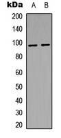 INSR (Phospho-Y1361) antibody