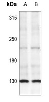 IRS1 (Phospho-S307) antibody