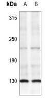 Anti-IRS1 (Phospho-S307) Antibody
