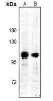 ITGB3 (Phospho-Y785) antibody