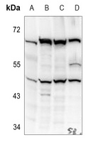 KCNJ2 antibody