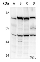 Anti-Kir2.1 Antibody
