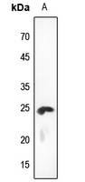 KDELR2 antibody