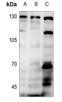 PRKD1 (Phospho-S738/S742) antibody