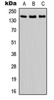 Anti-ASK1 (Phospho-S966) Antibody