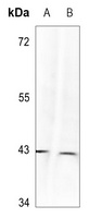 MAPK14 (Phospho-Y323) antibody