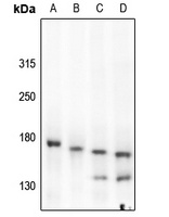 Anti-c-Met (Phospho-Y1349) Antibody