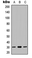 Anti-NDUFS3 Antibody