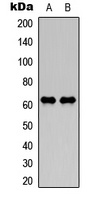 NEFL antibody