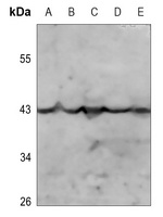 Anti-Kappa Opioid Receptor (Phospho-S369) Antibody