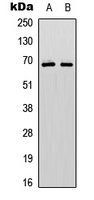 Anti-PAK1/2/3 (Phospho-S144/141/139) Antibody