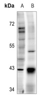 Anti-TOPK (Phospho-T9) Antibody