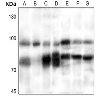 PFKM antibody