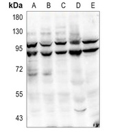 PIK3R1 (Phospho-Y467/199) antibody