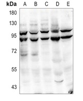 Anti-PI3K p85 alpha/p55 gamma (Phospho-Y467/199) Antibody